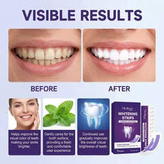 Purple Teeth Whitening Strips (Ultra Strong Whitening)