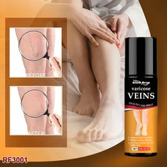 Turmeric Vericose Vein Relief Spray